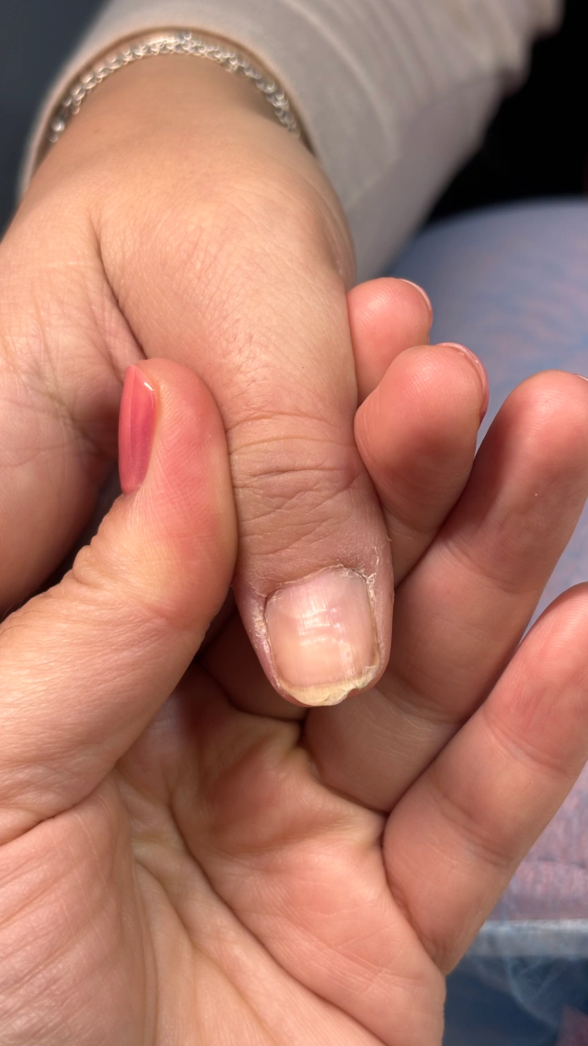 Uñas débiles y quebradizas: por qué pasa (cuando no es por el esmaltado)